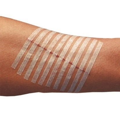 Steristrips Skin Closure Strips 6mm x 75mm (50 Packs Of 3 Strips)