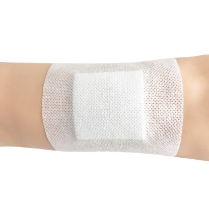 Softpore Adhesive Dressings